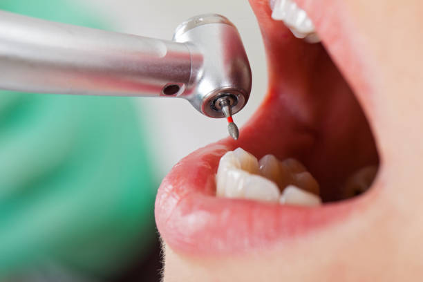 Best Emergency Dental Care for Sports Injuries in Overton, TX